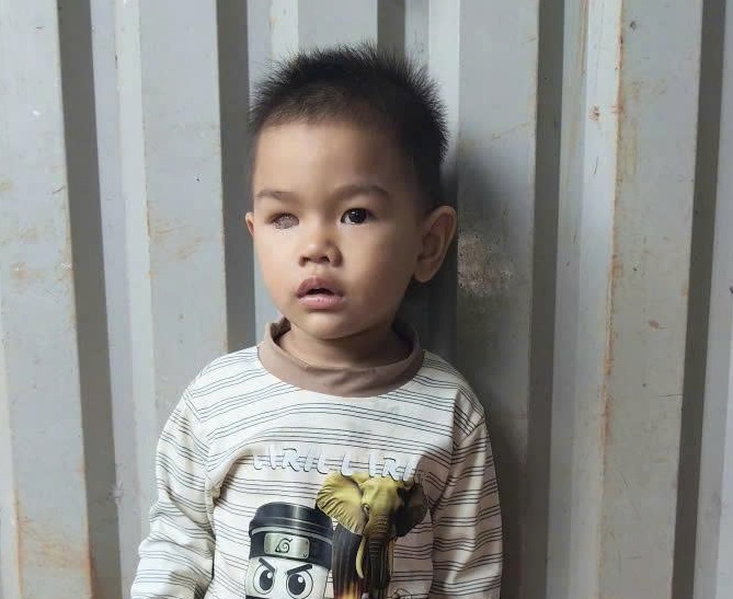 Bé Lê Bình An u nguyên bào võng mạc