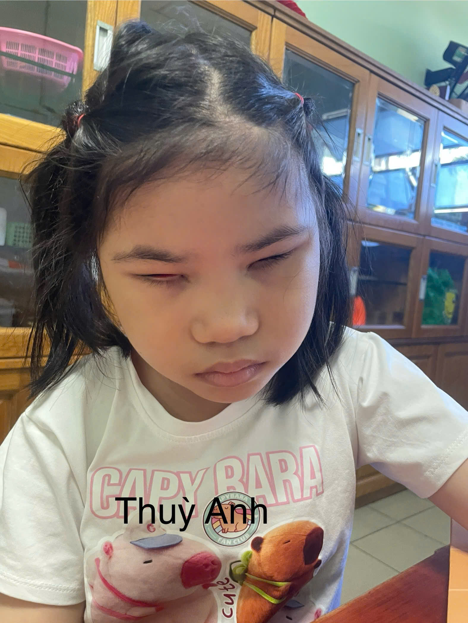 Em Trần Thùy Anh mắc dị tật chân